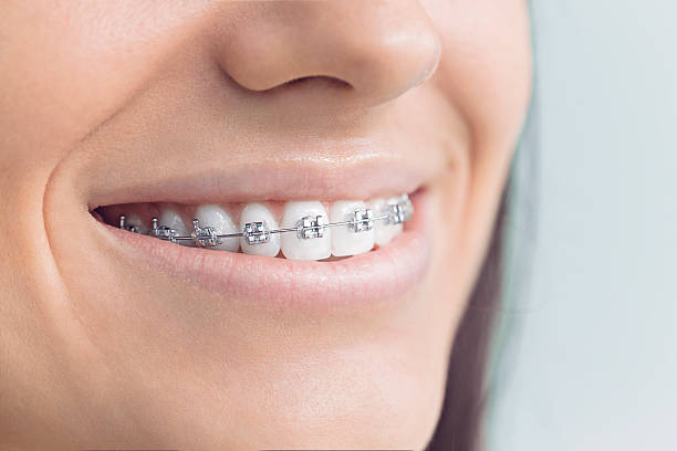 Best Traditional Braces  in Viroqua, WI